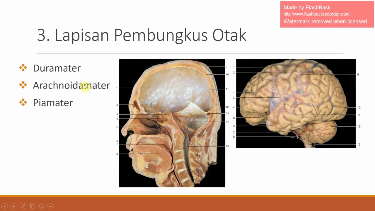 Anatomi Kepala Dan Otak