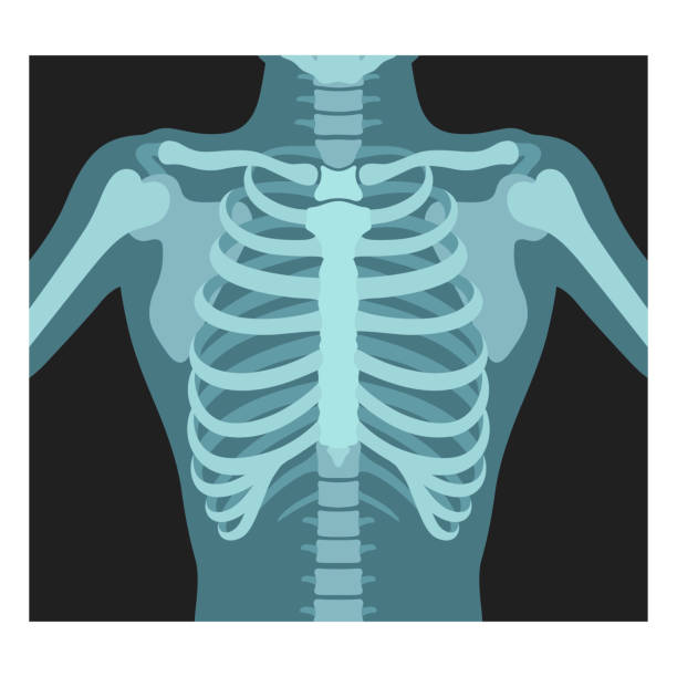 Chest X Ray Clipart