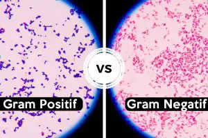 Contoh Bakteri Gram Positif Dan Negatif