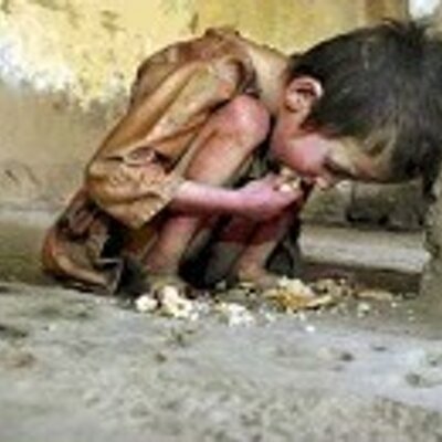 Gambar Anak Kelaparan