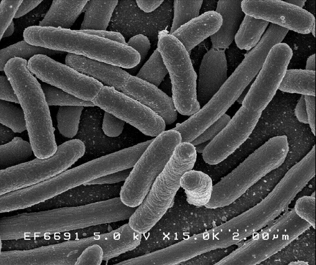 Gambar Bakteri Escherichia Colli
