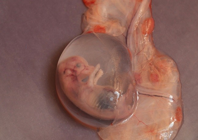 Gambar Bayi Aborsi Usia 1 Bulan