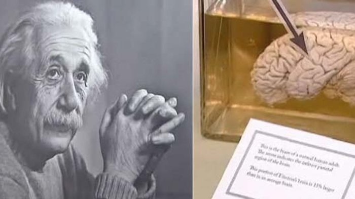 Gambar Otak Albert Einstein