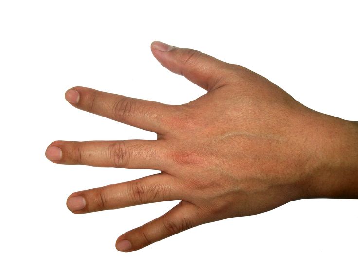 Hand Anatomie