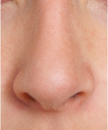 Png Nose